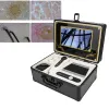 Traitements 9 pouces LCD analyseur de cheveux détecteur de peau 50X 200X peau cheveux cuir chevelu analyseur Microscope professionnel soins de la peau prise ue/US/UK