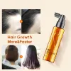 Prodotti ZHANGGUANG 101 RESHOW Siero nutriente per la crescita dei capelli Spray per cuoio capelluto 80ml Trattamento anticaduta senza odore