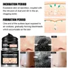 bamboo Charcoal Blackhead Remover Face Mask Care Deep Cleaning Oil Ctrol Shrink Pores Nose Black Dots Pore Clean Skin Care 245m#