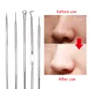 Black Dot Puistje Comedondrukker Tool Naalden Voor Knijpen Acne Gereedschap Spo voor Gezicht Reiniging Comede Extractor Porie Cleaner B2wO #