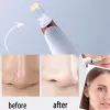 Elektrische Comedondrukker Vacuüm Porie Reiniging Facial Zwarte Vlekken White Dot Puistje Acne Cleaner Gezichtsverzorging Tool Schoonheid 14jJ #