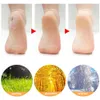 1Pair Feet Long Care Socks SEBS Moisturizing Silicone Gel Elasticity Socks Care Exfoliate Protectors Anti Cracking Spa Foot Skin 240322