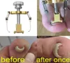 Corretor de unha encravada Ferramentas de cuidados com os unhas do pé do pé de pedicure Tratamento de pedicure em aço inoxidável
