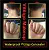 Wasserdichtes Vitiligo Gesicht Concealer Stift zum Abdecken von Händen Körper Leukasmus weiße Flecken aus der Haut Leukoderma Instant Make -up Flüssigkeit PE4525519