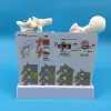 Miniaturen 2 Teile PVC Humanes anatomisches Modell Osteoporose Femur Beinknochen Wirbelsäulenabschnitt Probe erkrankte Lendenwirbelsäule