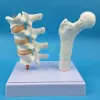 Miniaturen 2 Teile PVC Humanes anatomisches Modell Osteoporose Femur Beinknochen Wirbelsäulenabschnitt Probe erkrankte Lendenwirbelsäule