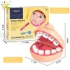 Huiqibao Doctor Dental Mold Toys de dentes plásticos Simulação Role -Reclamação Simulação Clay Tools Childrens Education Toys 240506