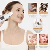 Instrumento de belleza en el hogar Piel ultrasónica Spárez Facial Spátula Facial Blackhead Remocalización Limpiador Comedo Extractor Dispositivo Levantamiento y pelado Q240508