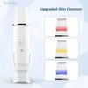 Nettoyage ultrasonic Skin Scurporber EMS VIBRATION ION ACNE RÉPOSITION DE CHEAR