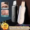 Cleaning Ultrasonic Peeling Machine Blackhead Removal Dark Facial Cleansing Ion Acne Hole Cleaning Scraper d240510