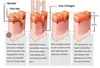 Résultat directement Lightrapy Thérapie Collagène Solarium Machine 630NM 850 NM Collagène Collagène Soins de la peau Capsule de blanchiment de la peau