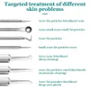 Rengöring Acne Needle Set Blackhead Stainless Steel Blackhead Clip Tizezers Hole Cleanser Female Facial Extractor Deep Cleaning Tool D240510