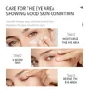 Ögonmask Sadoer Essence Eye Mask Plant Extrakt Fuktande ögonmask grossist