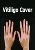 vitiligo 컨실러 액체 펜 방수 vitiligo 패치 천연 숨기기 백혈병 인스턴트 메이크업 피부 질병에 대한 솔루션 3643786