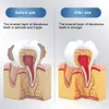 الإصلاح السريع للتجويف تسوس الأسنان إزالة بقع البلاك تسوس تبييض الصفرار إصلاح الأسنان تبييض 100 جرام جديد
