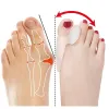 ツール8PCS = 4PAIR TOEセパレーターHALLUX VALGUS BUNION CORRECTOR ORTHOTICS FEET BONE親指アジャスター補正ペディキュアソックストレートナー