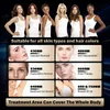 5 in 1 Elight dido laser machine OPT IPL hair removal RF skin tightening Pigmentation tattoo remove sales