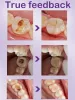 Dentalkaries Reparatur Serum verhindern Zähne Verfall Schutzzähne Entfernen Sie Plaque orale Reinigung natürlicher Kräuterextrakt 30ml