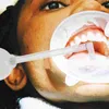 Caglie usa e getta cannuccia per dentifricio Detergente d'aria Brettri dentali ricaricabili per la pulizia Strumento di pietra orale