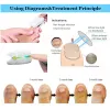 Accessoires FingerNails ToNails Toe nagelschimmel Koude lasertherapie Schimmelinfectie Draadloze behandeling Nagelpaddeigere apparaat