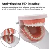 Adaptrar Dental Antifog Mirror for Dental Oral Photography Reflector Defog Mirror Orthodontic Buccal Occlusal Lingual Dental Supplies