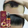 Krachtige haargroei serum spray reparatie voeding wortel hertrowth haar anti haren verlies behandeling essentie voor mannen vrouwen haarverzorging