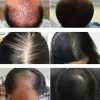 Krachtige haargroei serum spray reparatie voeding wortel hertrowth haar anti haren verlies behandeling essentie voor mannen vrouwen haarverzorging