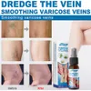 Spray para las venas varicosas Camina de alivio de la vena varicosa para aliviar la vasculitis de las piernas flebitis araña dolor de hinchazón