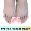 Pexmen 2/4pcs Gel Toe Proteration