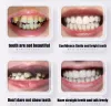 Sdotter ekovänliga falska tänder silikon övre nedre leende fanér perfekta skratt fanér tandproteser klistra in falska tänder stag tempora