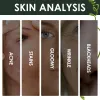Krimpporiën Verwijder acne markeringen Essentiële oliën Ontzoeting Stain Verwijder Pouch Licority Facial Essence vermindert rimpels acne