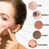 Pores rétrécissement du visage de la racine sérique Extrait d'huile essentielle d'huile anti-acné