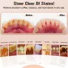 Irygatory Ultradźwiękowe skaler dentystyczne Zestaw do zębów Zestaw do usuwania zębów zębów zębów