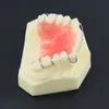 Trattamento ortodontico dentale Denti denti Modello typodont m3007 con fermo hawley per studio di studio di laboratorio dentale