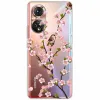 Pour Huawei Nova 9 SE / Nova9 Case transparent TPU Soft Cat Girl Clear Silicone Fundas pour Huawei Nova 9se Phone Shell Nova9se