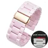 Titta på band Ceramic Watchband 22mm Band för Huawei Honor Dream Magic Ticwatch Sports Smart Pink Color Armband