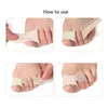 1pc Tissu Toe doigt lissener marteau orteil hallux valgus bandage bandage toe séparateur d'attelle outil de soins de la civière de pied