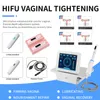 Ander lichaam beeldhouwen afslanke vaginale hifu hoge intensiteit gerichte ultrageluid vagina -rimpelverwijderingsapparaten behandelen voor vagina