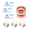 BRESTRI ORTODONTICHE BRETTERE DENTALI SORRICA ALLINE ALLINEARE ALLINEARE ALLINE ALLINEA