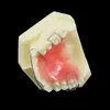 Modèle de dents de dents Orthodontics Traitement Bionator amovible for Dentistry Dentist Study Demo Dentures Dentures Hawley Retenue