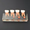 Dental Diş Modeli M4018 Endodontik Tedavi 4 Evreli Molar Kök Kanal Boyazları Öğretimi incelemek için