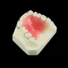 Modèle de dents de dents Orthodontics Traitement Bionator amovible for Dentistry Dentist Study Demo Dentures Dentures Hawley Retenue