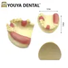 Maxillair implantaatmodel met zacht tandvlees implantaatonderwijsmodel voor tandheelkundige technicus praktijk training studeren model