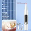 IRRIGADOR Xiaomi YouPin Visual Ultrassonic Scaler Electric Irrigador Oral Intelligente Limpeza Dental Dental Remoção de Instrumento Dental de Dentário