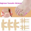 Toe Treatment Pedicure Sticker Ingrown Toenails Stickers Pedicure Tools Nail Care Patch Toenil Treating Corrector Stickers
