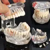 Sanat ve El Sanatları Diş İmplant Hastalığı Diş Modeli Restorasyon Köprüsü Diş Diş Hekimi Bilim Öğretimi Çalışmaları13329
