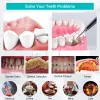 روي Nicare Scaler غسالة أسنان الأسنان بالموجات فوق الصوتية لإزالة أدوات تبييض تنظيف الأسنان القابلة لإعادة الشحن