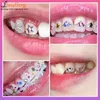 1set dentaire dentaires Gemmes Crystal Diamond Ornement outils de bricolage différentes formes Couleur dents Bijoux dentaire acrylique 240412