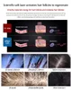 Taibo Hair Rebrowth High Fréquence / 650 Nm Laser Hair Rebrowth / Saldp Machine Hair Rebrowth Beauty Équipement de beauté