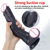 Dildo réaliste de la peau noire de 9,4 pouces avec une succion puissante à un pénis de pénis sexy arbre et balle incurvés douces flexibles de spot g flexible